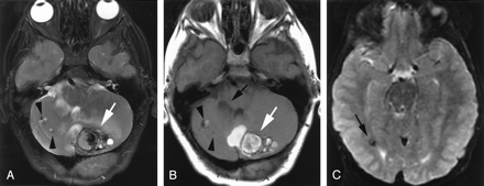 Fig 2.