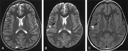 Fig 3.