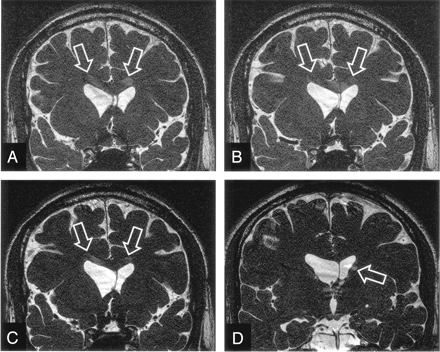 Fig 4.