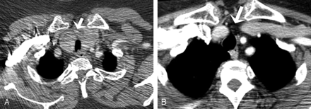 Fig 2.