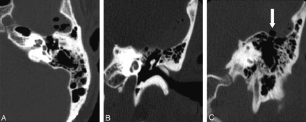 Fig 2.