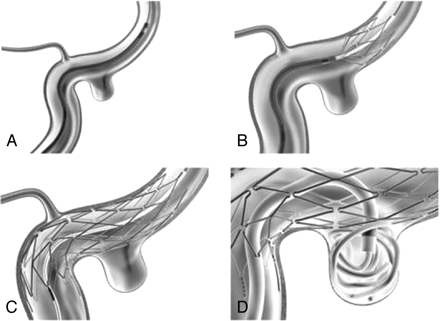 Fig 1.