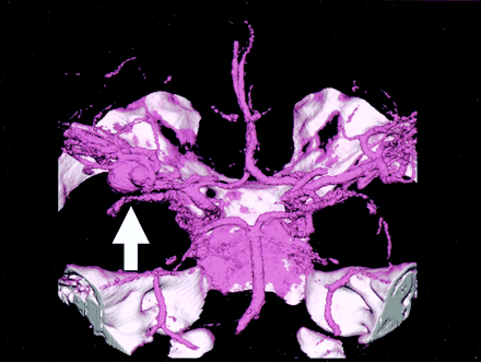 Fig 2.