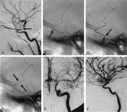 Fig 2.