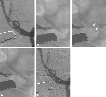 Fig 1.