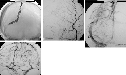 Fig 1.