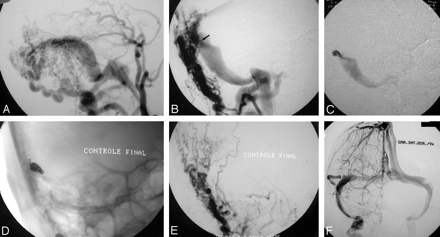 Fig 2.