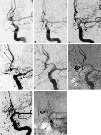 Fig 1.