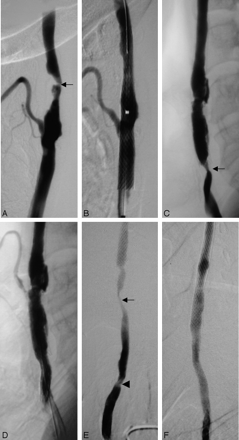 Fig 2.