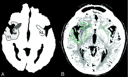 Fig 1.