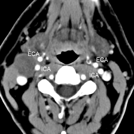 Fig 2.