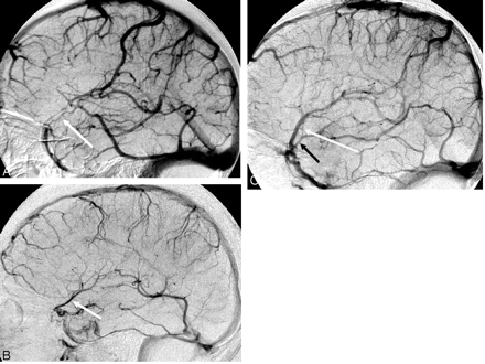 Fig 1.