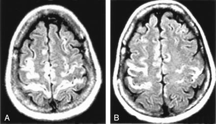 Fig 3.