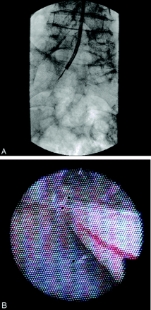 Fig 3.