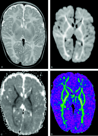 Fig 2.