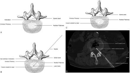 Fig 2.