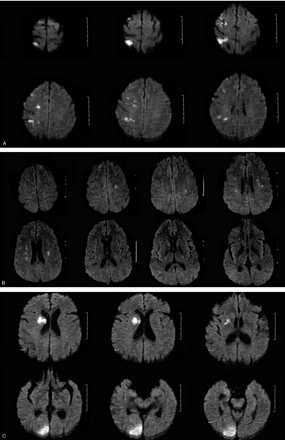 Fig 2.