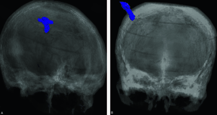 Fig 4.