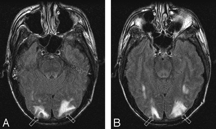 Fig 1.