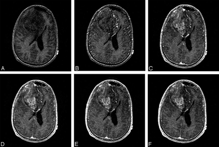 Fig 1.