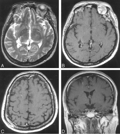 Fig 3.