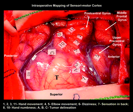 Fig 3.