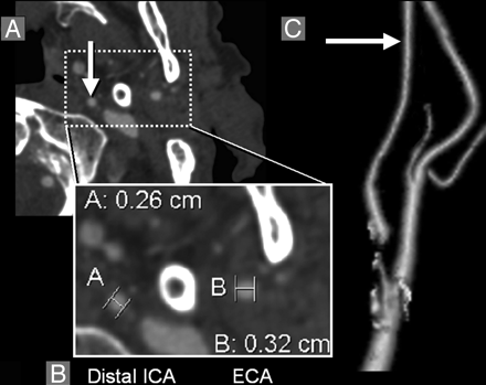 Fig 3.