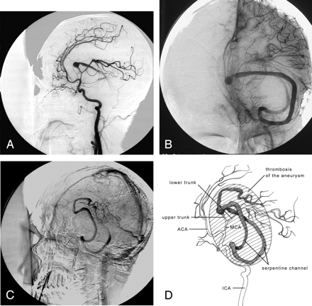 Fig 2.