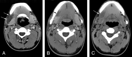 Fig 3.