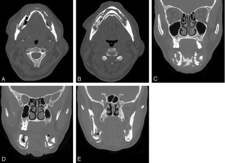   Fig 1. 