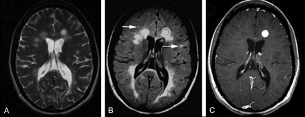 Fig 2.