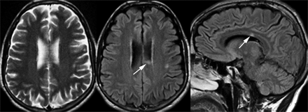 Fig 3.