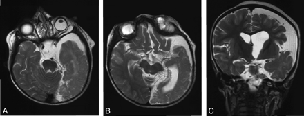 Fig 2.