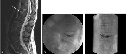 Fig 2.