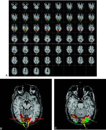 Fig 2.