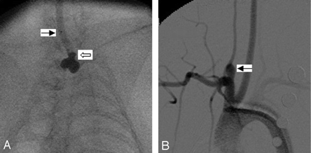 Fig 2.