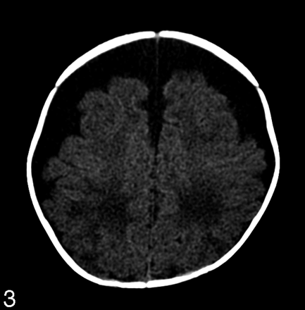 Fig 3.