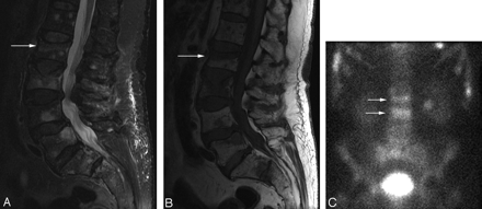 Fig 3.