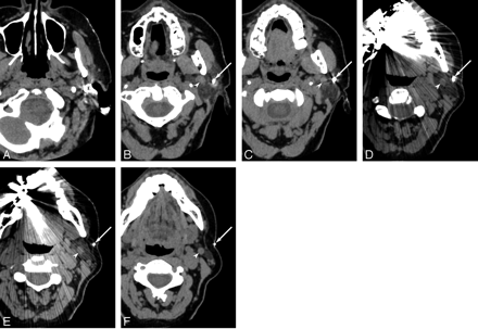 Fig 2.