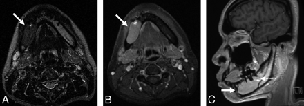 Fig 2.