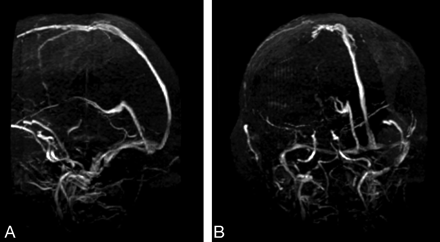 Fig 2.