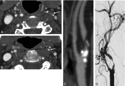 Fig 5.