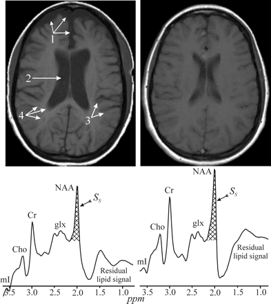 Fig 5.