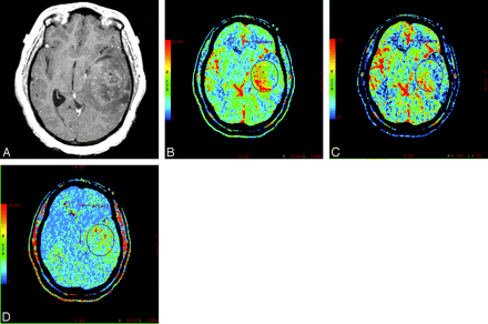 Fig 2.