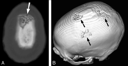 Fig 1.