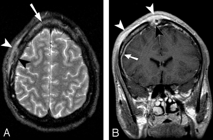 Fig 2.