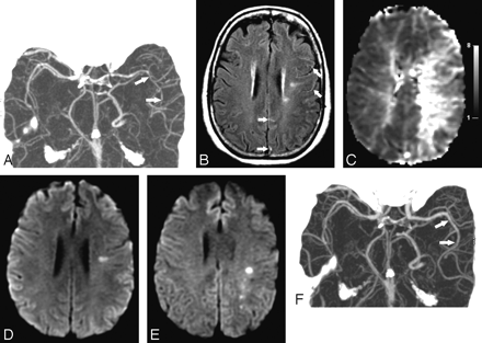   Fig 1. 