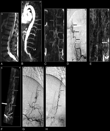 Fig 2.