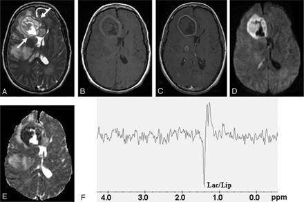 Fig 3.