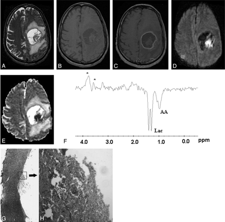 Fig 4.